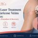 How laser tretment for Varicose Veins Works 1