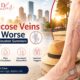 Why Varicose Veins Get Worse During Houston Summers 3 Why Varicose Veins Get Worse During Houson Summers